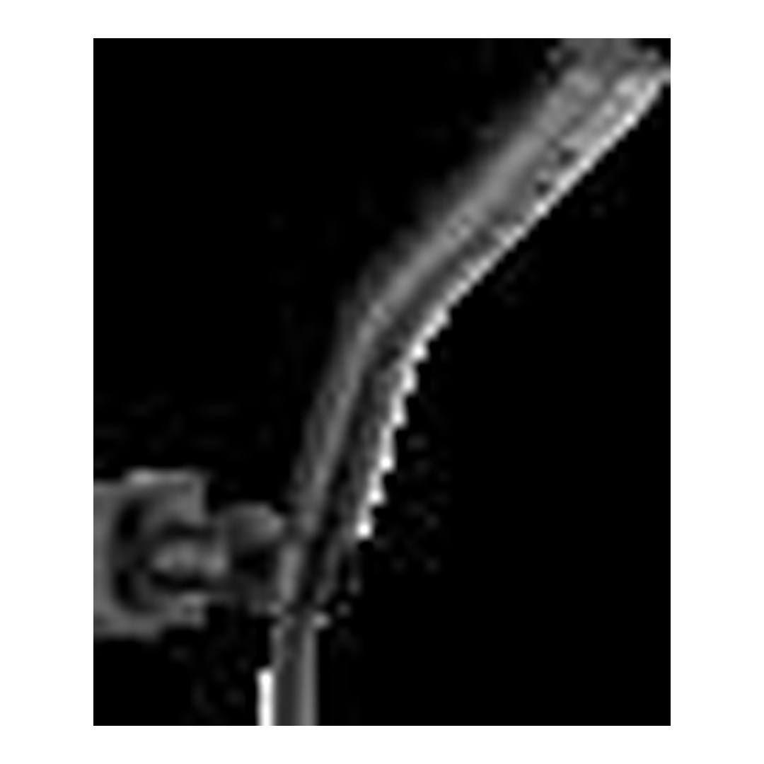 H2Okinetic Multi-Function Shower Head-BL
